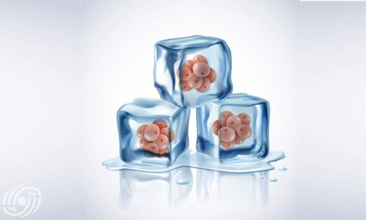 تجميد البويضات: طريقة للحفاظ على خصوبة المرأة