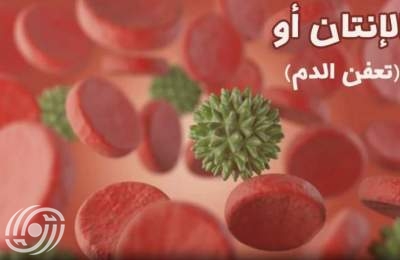 جامعة طهران..أمل جديد للتشخيص المبكر للإنتان جامعة طهران..أمل جديد للتشخيص المبكر للإنتان