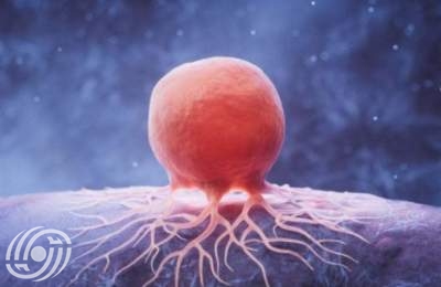 إيران تنتج أحد أكثر أدوية سرطان الدم تعقيدا إيران تنتج أحد أكثر أدوية سرطان الدم تعقيدا