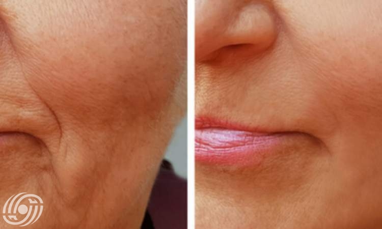 ما هو الكولاجين ولماذا هو مهم لصحة الجلد؟