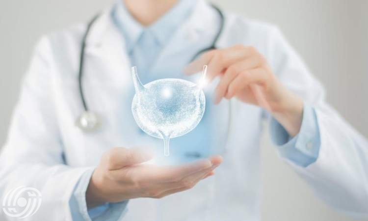 نجاح باحثين إيرانيين في علاج فرط نشاط المثانة