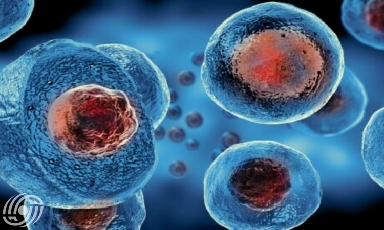 أول منتج إيراني للعلاج بالخلايا يدخل قائمة الأدوية في البلاد