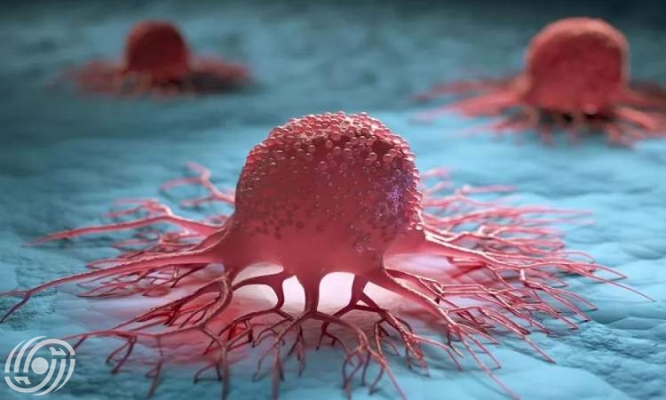 توطين صنع أدوات تشخيص وعلاج السرطان على يد باحثين إيرانيين